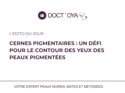 Pigmented Dark Circles: A Challenge for the Eye Contour in Skin of Color