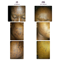 The changes I’ve seen each month have assured me of how good the IN’OYA products