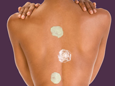 Peeling sur peau noire: conseillé ou déconseillé ?