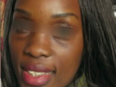 Lovado - Stains due to lightening products