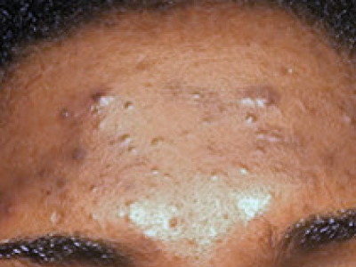 I FINALLY FOUND MYSELF AGAIN AFTER MY IN'OYA TREATMENT
